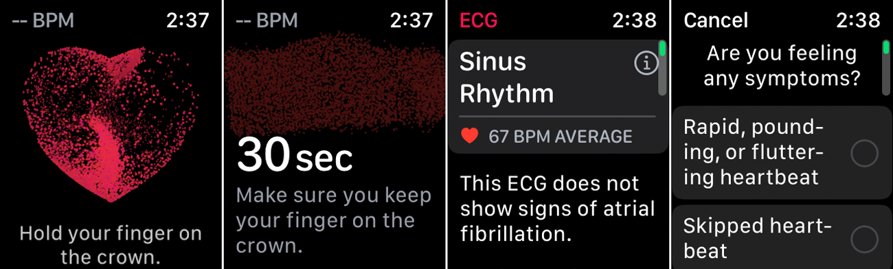 electrocardiograma