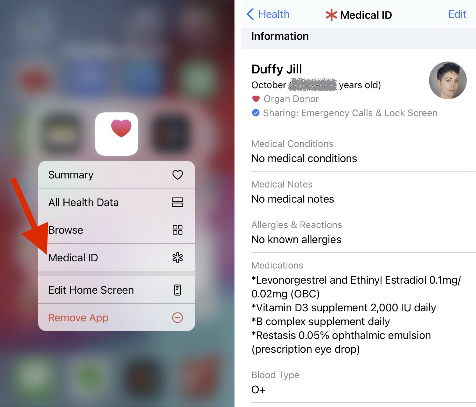 医療IDにアクセスするためにHealthアプリを長押ししているiPhone