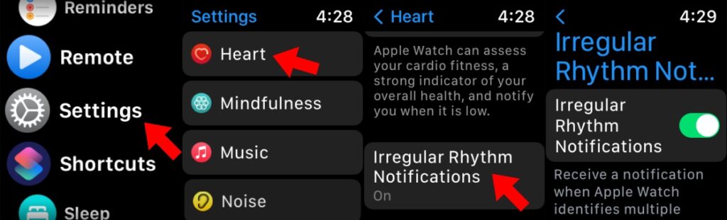 4AppleWatchで不規則なハースリズムを有効にする